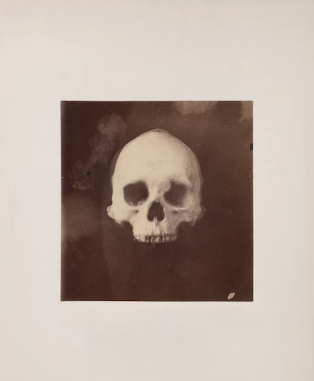 an old photo of a skull
